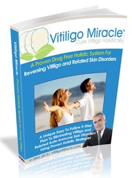 Read Full The Vitiligo Miracle Review Here