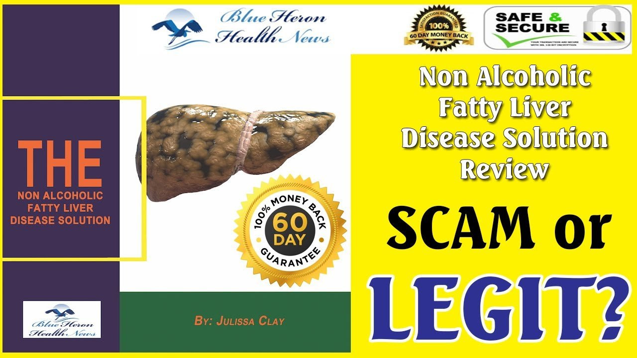 The Non Alcoholic Fatty Liver Disease Solution Review - Is It Scam?